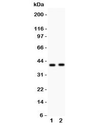 Western blot testing of NDRG2 antibody and Lane 1:  SMMC-7721;  2: PANC lysate.  Expected/observed molecular weight ~41kDa.