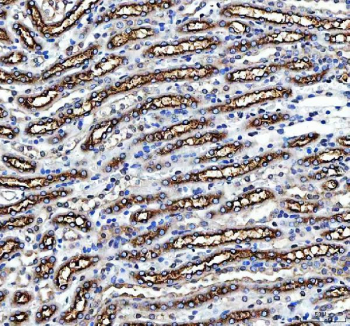 IHC staining of FFPE mouse kidney tissue with NKCC2 antibody, HRP-secondary and DAB substrate. HIER: boil tissue sections in pH8 EDTA for 20 min and allow to cool before testing.
