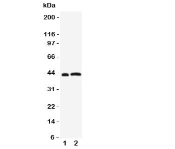 Western blot testing of Leupaxin antibody and Lane 1:  rat thymus;  2: human Jurkat cell lysate.  Expected/observed size ~43KD