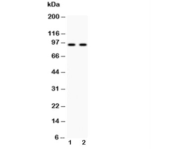 Western blot testing of Cadherin 17 antibody and 1) human HeLa and 2) human SW620 cell lysate. Predicted molecular weight ~92 kDa but may be observed at higher molecular weights due to glycosylation.