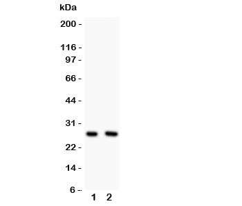 Western blot testing of Olig1 antibody and Lane 1:  U87;  2: HeLa lysate