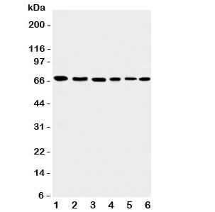 Western blot testing of Apoptosis-Inducing Factor antibody and Lane 1:  rat heart;  2: (r) brain;  3: human K562;  4: (h) HEPG2;  5: (h) A431;  6: mouse NIH3T3 cell lysate.  Expected/observed molecular weight: ~67kDa.