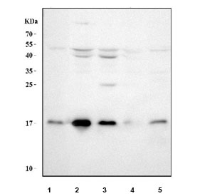 Western blot testing of 1) human placenta, 2) human K562, 3) human HepG2, 4) rat brain and 5) rat kidney tissue lysate with UBC9 antibody.  Predicted molecular weight ~18 kDa.