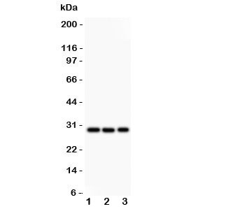 Western blot testing of CSEN antibody and Lane 1:  HeLa;  2: U87;  3: SHG-44 lysate. Predicted/observed molecular weight: ~29kDa.