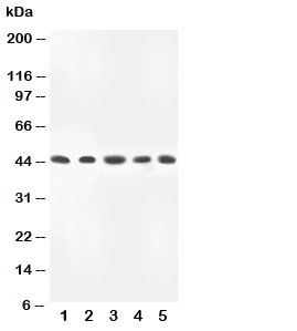 Western blot testing of MKK4 antibody and Lane 1:  rat skeletal muscle;  2: HeLa;  3: A549;  4: MM231;  5: CEM lysate.  Predicted molecular weight ~44 kDa.