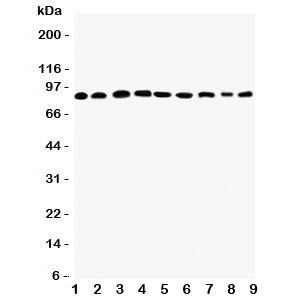 Western blot testing of Plakophilin 2 antibody and Lane 1:  rat heart;  2: human placenta;  3: (r) brain;  4: (r) intestine;  5: (h) HeLa;  6: (h) Jurkat;  7: (h) 293T;  8: (h) MCF-7;  9: (h) U87 lysate. Predicted molecular weight: 93-97 kDa.