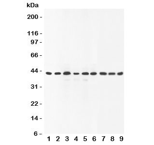 Western blot testing of SOX7 antibody and Lane 1:  rat brain;  2: human placenta;  3: (r) lung;  4: (r) testis;  5: (h) HeLa;  6: (h) A549;  7: (h) HEPG2;  8: (h) SMMC-7721;  9: mouse Neuro-2a lysate