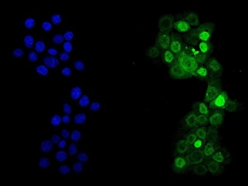 Immunofluorescent staining of FFPE human A431 cells with p53 antibody (green) and DAPI nuclear stain (blue). HIER: steam section in pH6 citrate buffer for 20 min.