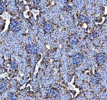 IHC staining of FFPE mouse kidney tissue with Annexin V antibody, HRP-labeled secondary and DAB substrate. HIER: boil tissue sections in pH8 EDTA for 20 min and allow to cool before testing.