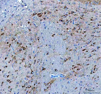 IHC-P staining of mouse brain tissue with BDNF antibody. HIER: steam section in pH8 EDTA buffer for 20 min and allow to cool prior to staining.
