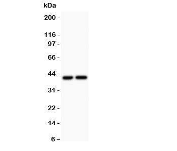 Western blot testing of CXCR3 antibody and Lane 1:  COLO320;  2: SGC lysate.  Predicted molecular weight ~41 kDa.