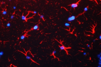 Immunofluorescent staining of FFPE mouse brain with GFAP antibody (red) and DAPI nuclear counterstain (blue). HIER: boil tissue sections in pH6, 10mM citrate buffer, for 10-20 min followed by cooling at RT for 20 min.