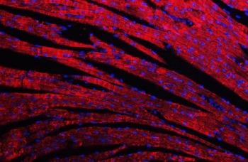 Immunofluorescent staining of FFPE mouse heart tissue with Desmin antibody (red) and DAPI nuclear stain (blue). HIER: steam section in pH8 EDTA buffer for 20 min.