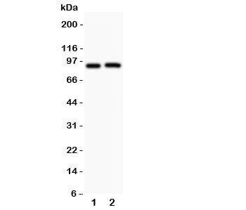 Western blot testing of Kv2.1 antibody  and Lane 1:  rat brain;  2: mouse brain. Predicted molecular weight ~96 kDa.
