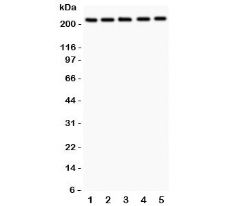 Western blot testing of TSC2 antibody and human samples 1:  U20S;  2: PANC;  3: HEPG2;  4: A549;  5: COLO320.  Expected/observed size 200~220KD