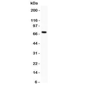 Western blot testing of Estrogen Receptor antibody and MCF-7 lysate (human breast tumor cell line).  Predicted molecular weight ~67 kDa.