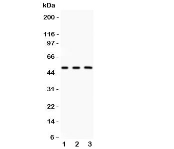 Western blot testing of GATA3 antibody and Lane 1:  rat brain;  2: human MCF-7;  3: (h) HEPG2.  Predicted molecular weight: 50 kDa