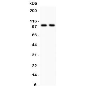Western blot testing of GLUR1 antibody and Lane 1: rat brain; 2: mouse brain lysate.  Predicted molecular weight ~102 kDa.