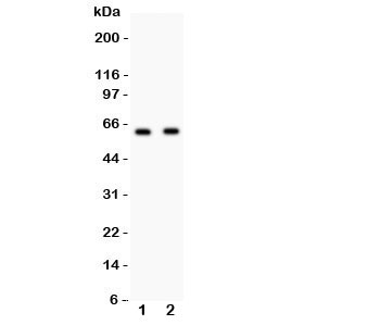 Western blot testing of HEXB antibody and Lane 1:  HeLa;  2: HEPG2 lysate. Predicted/observed size ~63KD