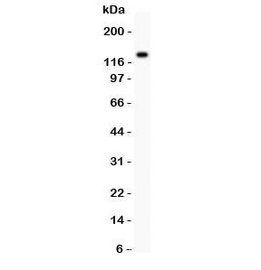 Western blot testing of ZEB2 antibody and SMMC-7721 lysate.  Predicted molecular weight  120~136 kDa.