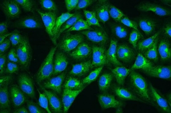 Immunofluorescent staining of FFPE human U-2 OS cells with HSP27 antibody (green) and DAPI nuclear stain (blue). HIER: steam section in pH6 citrate buffer for 20 min.