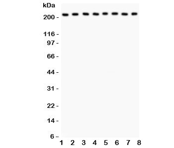 Western blot testing of Integrin alpha 5 antibody and Lane 1:  rat brain;  2: mouse brain;  3: human MM231;  4: (h) HeLa;  5: (h) Jurkat;  6: (h) 293T;  7: (m) Neuro-2a;  8: (r) PC12 lysate;  Expected molecular weight: 115-160 kDa, observed here at ~220 kDa.