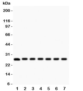Western blot testing of Galectin 3 antibody and mouse samples 1:  kidney;  2: liver;  3: spleen;  4: ovary;  5: HEPA;  6: ANA-1;  7: NIH3T3 lysate.  Predicted/observed molecular weight ~26kDa