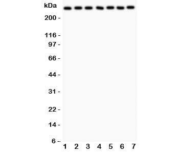 Western blot testing of LRRK2 antibody and Lane 1:  rat brain;  2: mouse brain;  3: (r) liver;  4: human U87;  5: (m) Neuro-2a;  6: (h) A549;  7: (h) SMMC-7721 lysate.  Expected/observed size ~280KD