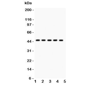 Western blot testing of PIM-1 antibody and human samples 1:  U20S;  2: A549;  3: COLO320;  4: SW620;  5: Jurkat.  Western blot testing of human Jurkat cell lysate with PIM1 antibody. Predicted molecular weight ~44 kDa (PIM-1L) and ~34 kDa (PIM-1S).