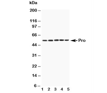 Western blot testing of Caspase-8 antibody and mouse samples:  1. Spleen, 2. Thymus, 3. Kidney, 4. Lung, 5. HEPA1-6 cell lysate. Predicted molecular weight: ~55 kDa (pro), ~40 kDa (large + small subunit), ~11 kDa (small subunit).