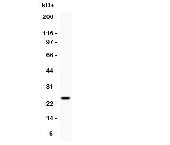 Western blot testing of Prolactin antibody and MCF7 lysate.  Predicted/observed molecular weight: ~25kDa.