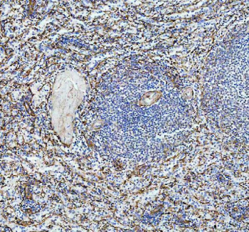 IHC staining of FFPE human spleen tissue with P-Selectin antibody, HRP-labeled secondary and DAB substrate. HIER: boil tissue sections in pH8 EDTA for 20 min and allow to cool before testing.