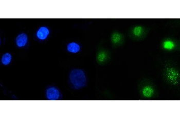 Immunofluorescent staining of FFPE human A549 cells with ARID1A antibody (green) and DAPI nuclear stain (blue). HIER: steam section in pH6 citrate buffer for 20 min.