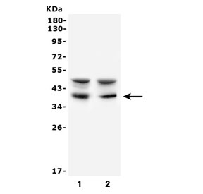 Western blot testing of 1) human Raji and 2) mouse NIH3T3 cell lysate with AIM2 antibody. Expected molecular weight: 40-45 kDa.