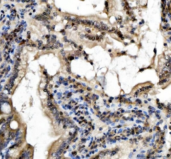 IHC staining of FFPE rat colon tissue with SLUG antibody. HIER: boil tissue sections in pH8 EDTA for 20 min and allow to cool before testing.