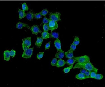 Immunofluorescent staining of FFPE human A431 cells with AMPK beta 2 antibody (green) and DAPI nuclear stain (blue). HIER: steam section in pH6 citrate buffer for 20 min.