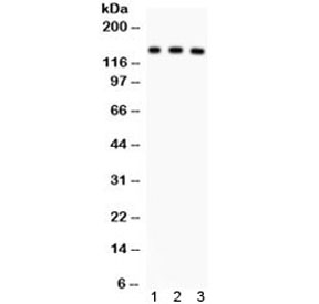 Western blot testing of 1) rat liver, 2) mouse liver and 3) human SMMC lysate with ABCB11 antibody. Expected/observed molecular weight ~146 kDa.