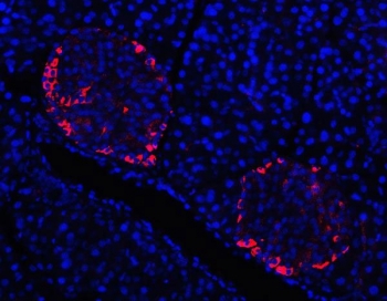 Immunofluorescent staining of FFPE mouse pancreas tissue with TTR antibody (red) and DAPI nuclear stain (blue). HIER: steam section in pH6 citrate buffer for 20 min.