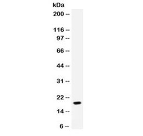 Western blot testing of human MCF7 cell lysate with NAP-2 antibody. Predicted molecular weight: 8~14 kDa.