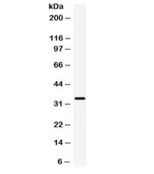 Western blot testing of human HeLa cell lysate with CXCL10 antibody. Expected molecular weight 8~11 kDa, observed here at ~34 kDa.