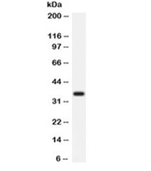 Western blot testing of rat liver lysate with Arginase antibody. Expected weight ~35 kDa.