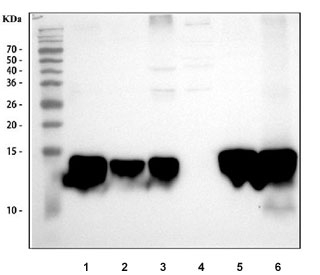 Western blot testing of 1) rat liver, 2) rat intestine, 3) rat RH35, 4) rat PC-12, 5) mouse liver and 6) mouse small intestine tissue lysate with FABP antibody. Predicted molecular weight: ~14 kDa.