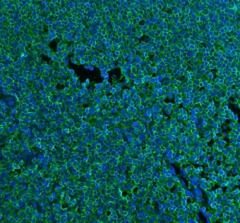 Immunofluorescent staining of FFPE human tonsil tissue with CD45 antibody (green) and DAPI nuclear stain (blue). HIER: Boil the paraffin sections in pH8 EDTA buffer for 20 minutes and allow to cool prior to staining.