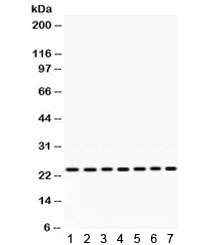 Western blot testing of rat 1) brain, 2) thymus, 3) testis, 4) mouse thymus, 5) mouse liver, 6) human HeLa and 7) human MCF7 lysate with RALA antibody. Expected/observed molecular weight ~24 kDa.