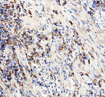 IHC staining of FFPE human appendix tissue with anti-CD19 antibody. HIER: boil tissue sections in pH8 EDTA for 20 min and allow to cool before testing.