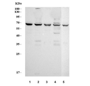 Western blot testing of 1) human SW620, 2) human COLO-320, 3) human ThP-1, 4) human K562 and 5) mouse ANA-1 cell lysate with TNFRSF1B antibody. Predicted molecular weight: 50~80 kDa depending on glycosylation level.