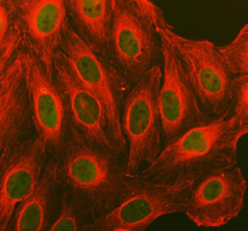 Immunofluorescent staining of FFPE human U-2 OS cells with Cyclin D1 antibody (green) and Alpha Tubulin mAb (red). HIER: steam section in pH6 citrate buffer for 20 min.
