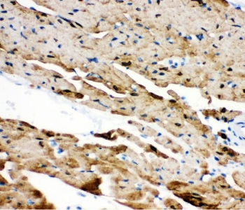 IHC staining of FFPE mouse heart tissue with PLN antibody. HIER: boil tissue sections in pH8 EDTA for 20 min and allow to cool before testing.