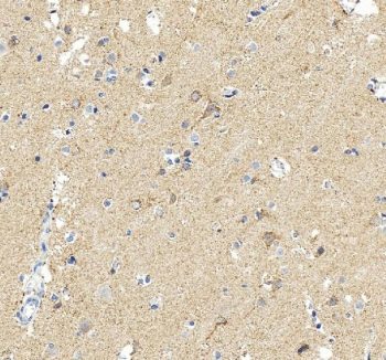 IHC staining of FFPE human brain tissue with MAOB antibody, HRP-secondary and DAB substrate. HIER: boil tissue sections in pH8 EDTA for 20 min and allow to cool before testing.
