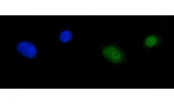 Immunofluorescent staining of FFPE human A549 cells with RPA1 antibody (green) and DAPI nuclear stain (blue). HIER: steam section in pH6 citrate buffer for 20 min.